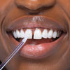 Frau mit weißen Zähnen und Bleaching Glow Stick von Diamond Smile am Zahn
