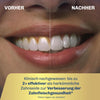 Bleaching Munddusche Hydro+