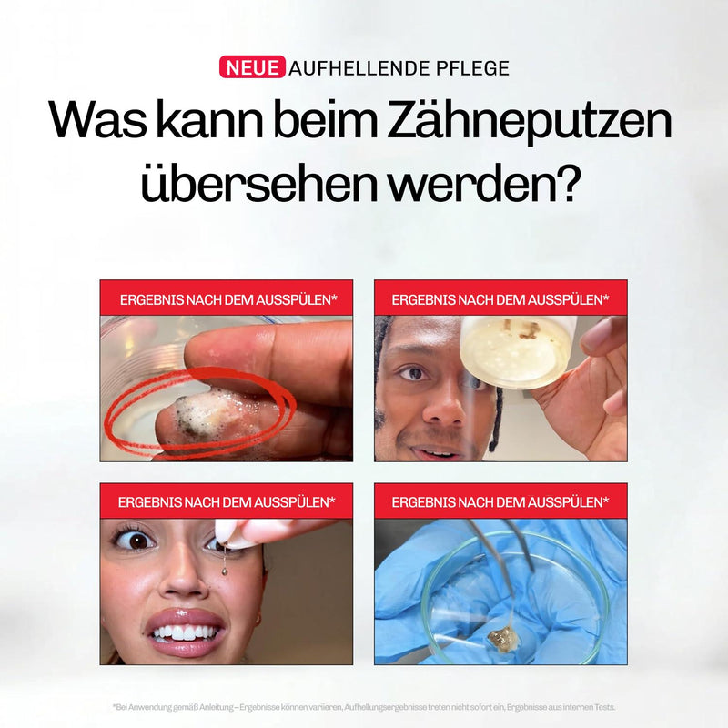 Whitening Mundspülung iD+