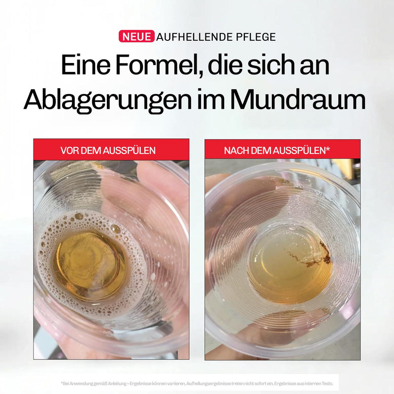 Whitening Mundspülung iD+
